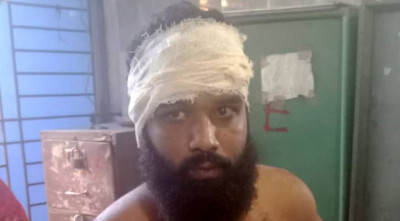 হাতুড়ি দিয়ে ছাত্রলীগ নেতাকে পিটিয়ে আহত করলো ছাত্রদল